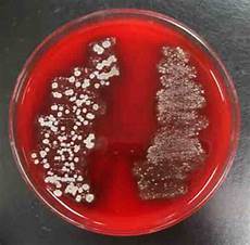 Microbial
